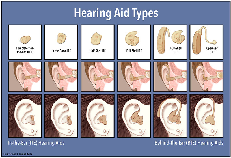 How To Select The Right Hearing Aid Puget Sound Consumers Checkbook